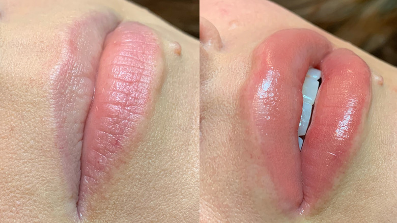 A woman before and after lip blushing 