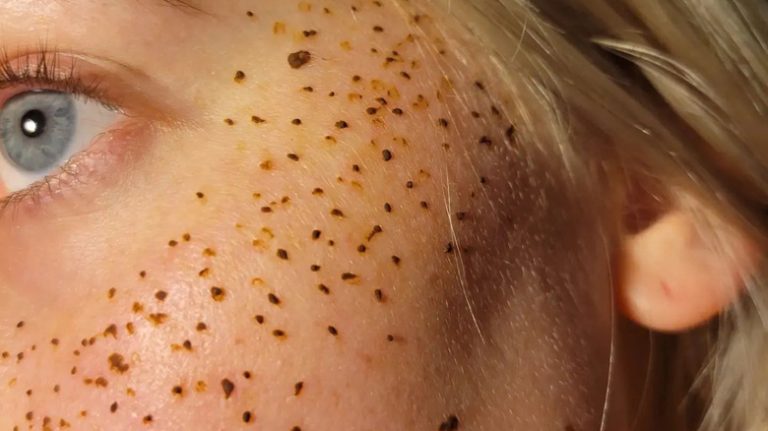Why We Can't Wait To Ditch Henna Tattoo Freckles