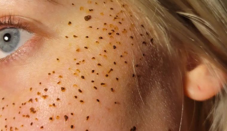 Why We Can't Wait To Ditch Henna Tattoo Freckles